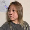 クマ治療 / 脂肪吸引（顔） 新宿美容外科ネビュラクリニック DAY 28 サムネイル用