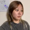 クマ治療 / 脂肪吸引（顔） 新宿美容外科ネビュラクリニック DAY 28 サムネイル用