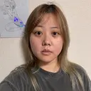 クマ治療 / 脂肪吸引（顔） 新宿美容外科ネビュラクリニック DAY 28 サムネイル用