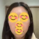 インモード Moon Beauty Clinic DAY 6 サムネイル用