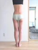 脂肪吸引（脚） / 脂肪吸引（お腹） / 脂肪吸引（お尻） ラインカルチャークリニック DAY 50 サムネイル用