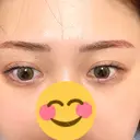 アートメイク（眉） G MEDICAL ART クリニック 新宿院 AFTER サムネイル用