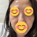 肌育注射（ジュベルックなど） / その他（肌） ゆきスキンクリニック 東池袋 AFTER サムネイル用