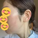 インモード Moon Beauty Clinic DAY 8 サムネイル用