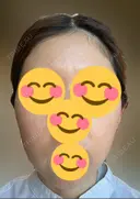 インモード Moon Beauty Clinic DAY 8 サムネイル用