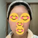 インモード Moon Beauty Clinic AFTER サムネイル用