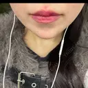 ボトックス（あご） / ヒアルロン酸注入（あご） / ヒアルロン酸注入（唇） HAAB×DREAM BEAUTY CLINIC 大阪梅田院 AFTER サムネイル用