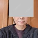 糸リフト 銀座美容外科クリニック 銀座院 AFTER サムネイル用