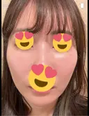 毛穴洗浄（ハイドラフェイシャルなど） / ピコレーザートーニング（美白・肝斑） 表参道ウィズ・クリニック DAY 1 サムネイル用