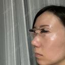 その他（鼻） / 軟骨移植 / ワシ鼻修正・ハンプ切除 / 真皮移植 LUHO（ルホ）美容外科 DAY 122 サムネイル用