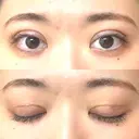 二重切開 EMMA CLINIC（エマクリニック） DAY 19 サムネイル用