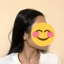 糸リフト / 脂肪吸引（顔） EMMA CLINIC（エマクリニック） DAY 98 サムネイル用