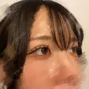 二重埋没 東京シンデレラ美容外科 池袋院 DAY 12 サムネイル用