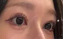 二重埋没 / 目尻切開 / 自然癒着法 Stand by Beauty Clinic DAY 95 サムネイル用