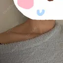 ボトックス（エラ・小顔） / ボトックス（肩） 新未来クリニック AFTER サムネイル用