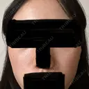 光治療（フォトフェイシャルなど） レナータクリニック 立川院 AFTER サムネイル用