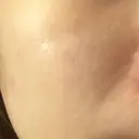 医療脱毛（顔） S-Laboクリニック 渋谷院 DAY 0 サムネイル用