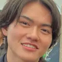 眼瞼下垂（切開） / 上まぶたの脂肪取り 新前橋かしま眼科形成外科クリニック DAY 168 サムネイル用