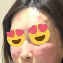 デンシティ Lumiera Clinic AFTER サムネイル用