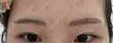 アートメイク（眉） G MEDICAL ART クリニック 新宿院 AFTER サムネイル用