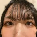 二重埋没 東京シンデレラ美容外科 池袋院 DAY 19 サムネイル用