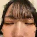 二重埋没 東京シンデレラ美容外科 池袋院 DAY 19 サムネイル用