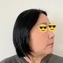 脂肪溶解注射（顔） ルラ美容クリニック 仙台院 / ルラスキンクリニック 仙台院 DAY 4 サムネイル用