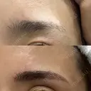 アートメイク（眉） 表参道メディカルクリニック 広島院 AFTER サムネイル用