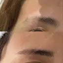 アートメイク（眉） 表参道メディカルクリニック 広島院 DAY 0 サムネイル用