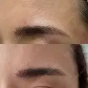 アートメイク（眉） 表参道メディカルクリニック 広島院 DAY 0 サムネイル用