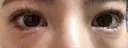 目尻切開 / タレ目形成・グラマラスライン（埋没） LOUIS CLINIC 二子玉川院【ルイクリニック】 DAY 3 サムネイル用