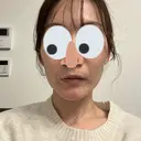 ハイフ（顔） Natural Skin Clinic 自由ヶ丘院 AFTER サムネイル用