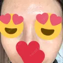 ピコスポット Fellez Clinic【フェルズクリニック】 AFTER サムネイル用