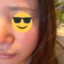 ルメッカ BITO BEAUTY CLINIC DAY 0 サムネイル用