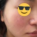 ルメッカ BITO BEAUTY CLINIC DAY 0 サムネイル用