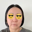 脂肪溶解注射（顔） ルラ美容クリニック 仙台院 / ルラスキンクリニック 仙台院 DAY 5 サムネイル用