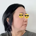 脂肪溶解注射（顔） ルラ美容クリニック 仙台院 / ルラスキンクリニック 仙台院 DAY 5 サムネイル用