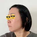 脂肪溶解注射（顔） ルラ美容クリニック 仙台院 / ルラスキンクリニック 仙台院 DAY 5 サムネイル用