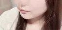ヒアルロン酸注入（涙袋） / ヒアルロン酸注入（唇） / ボトックス（口角） フィラークリニック 大阪心斎橋院 DAY 1 サムネイル用