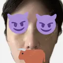 隆鼻術 / 鼻尖形成（切開） / 軟骨移植 / 鼻中隔延長（非切開） X CLINIC 大阪院 DAY 13 サムネイル用