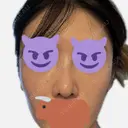 隆鼻術 / 鼻尖形成（切開） / 軟骨移植 / 鼻中隔延長（非切開） X CLINIC 大阪院 DAY 26 サムネイル用