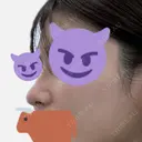 隆鼻術 / 鼻尖形成（切開） / 軟骨移植 / 鼻中隔延長（非切開） X CLINIC 大阪院 DAY 135 サムネイル用