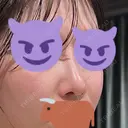 隆鼻術 / 鼻尖形成（切開） / 軟骨移植 / 鼻中隔延長（非切開） X CLINIC 大阪院 DAY 166 サムネイル用