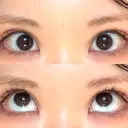 タレ目形成・グラマラスライン（切開） 形成外科と美容外科のクリニック池袋 AFTER サムネイル用