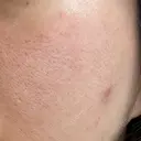 ポテンツァ 大美会クリニック 岡山院 DAY 1 サムネイル用