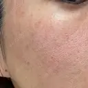 ポテンツァ 大美会クリニック 岡山院 DAY 1 サムネイル用