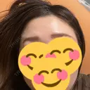 ボトックス（あご） / ボトックス（額） 湘南美容クリニック 名古屋駅本院 AFTER サムネイル用