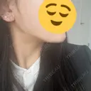 糸リフト / 脂肪吸引（顔） / ボトックス（エラ・小顔） Wing clinic 豊中駅前院 DAY 70 サムネイル用