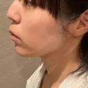 インモード TUNE CLINIC【チューンクリニック】 DAY 1 サムネイル用