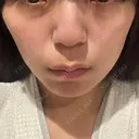 インモード TUNE CLINIC【チューンクリニック】 DAY 1 サムネイル用